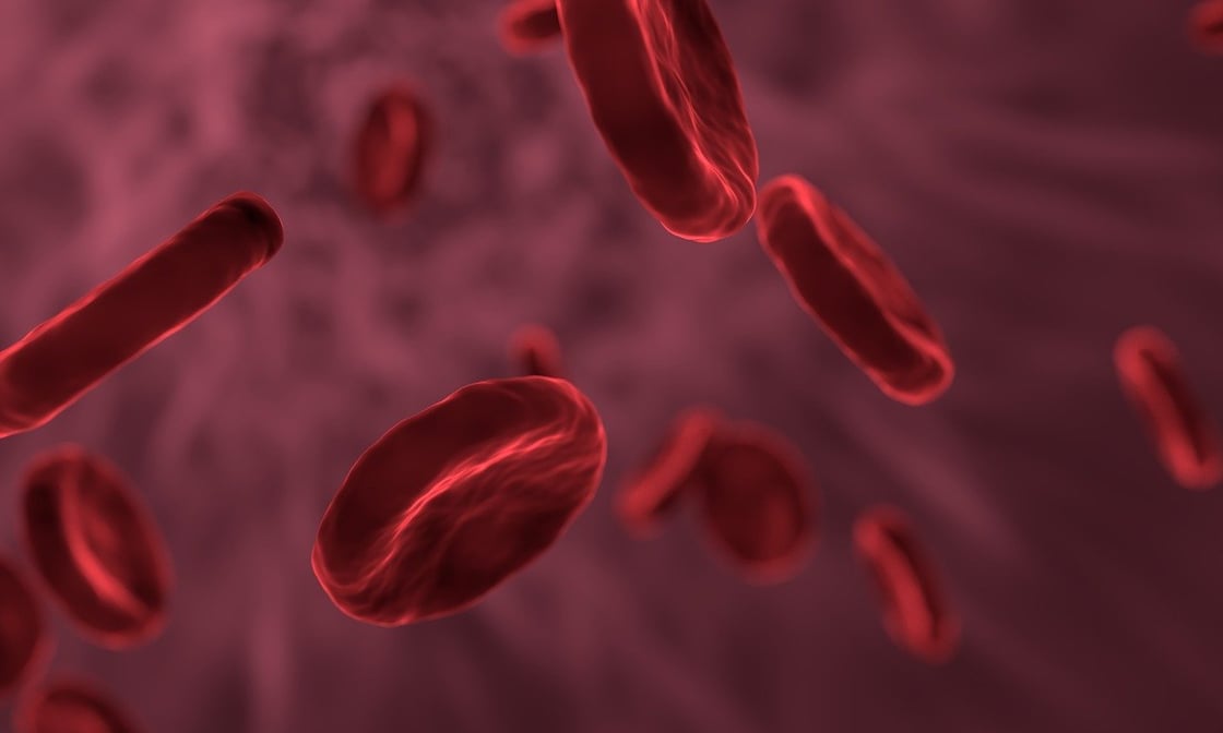 IHY_Curare_leucemia_linfoma_Hodgkin_Gaslini_Genova_Dufour_sopravvivenza_ematologia_pediatrica_LLA_leucemia_linfoblastica_acuta_emofilia