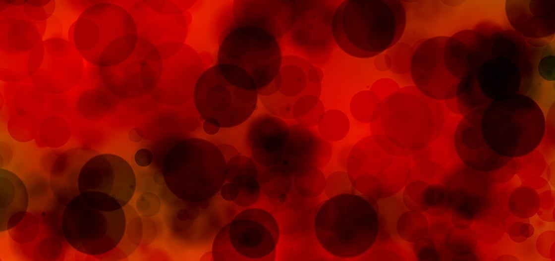IHY_Leucemia_Linfoblastica_Acuta_Tumore_Sangue_Leucemia_Globuli_Bianchi_Rossi_Ematologia_Dufour_Gaslini_Genova_Pediatria_Leucemia_Linfoide_Mieloide_Cronica