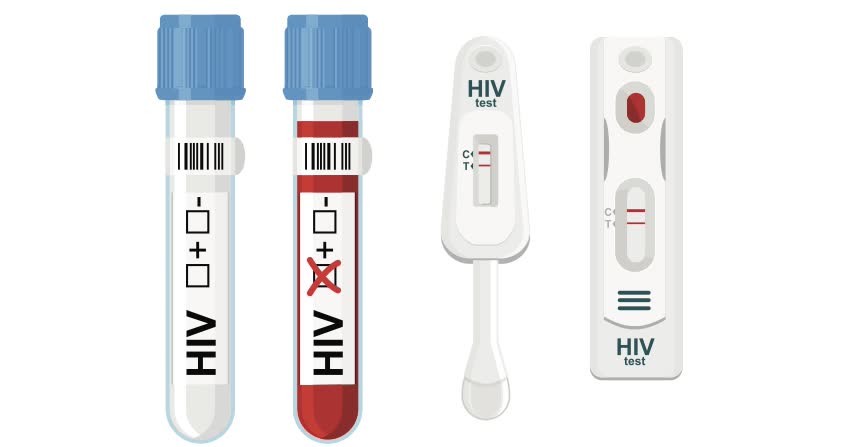 Test diagnostico HIV