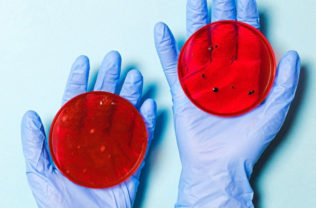 Colture in vitro per individuare batteri