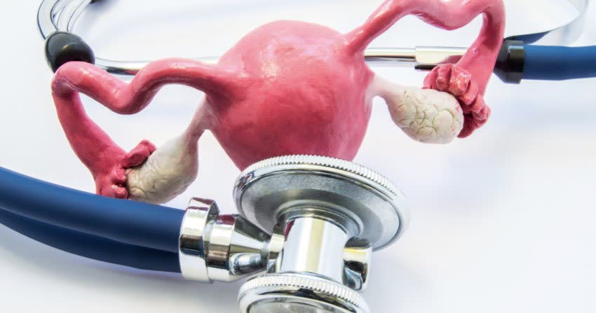 Modellino di utero e ovaie con stetoscopio a indicare problematiche ginecologiche