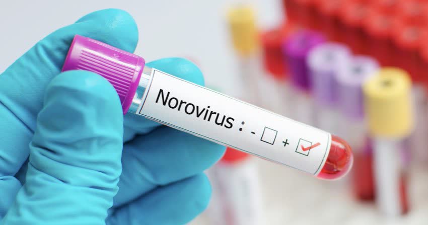 Campione positivo per il norovirus