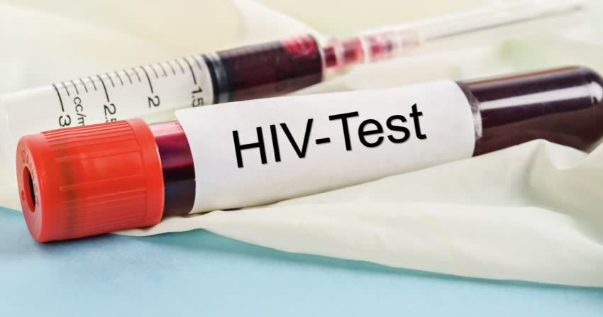 Close up test HIV