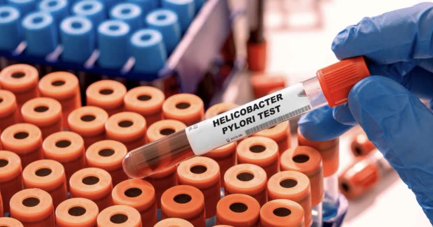 Immagine rappresentativa di gruppi di campioni per test per positività all'Helicobacter pylori