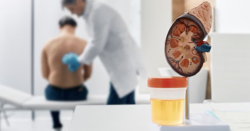 Campione di urina vicino a modellino di rene con sullo sfondo un paziente visitato da un urologo