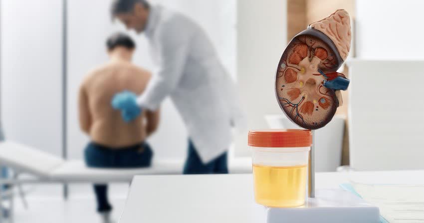 Modellino di rene con campione di urina con paziente ed urologo sullo sfondo