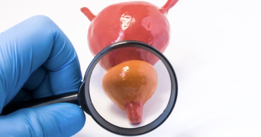 Modellino di prostata osservato attraverso una lente di ingrandimento 