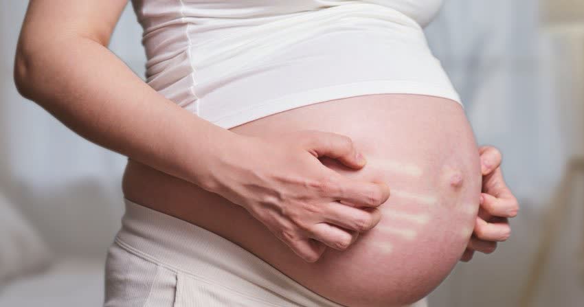 Close up pancia persona in gravidanza con rossore e prurito