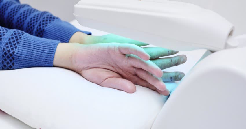 Close up mani sottoposte a fototerapia per la psoriasi