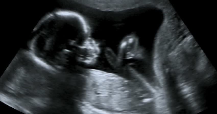 Immagine ecografica di un feto