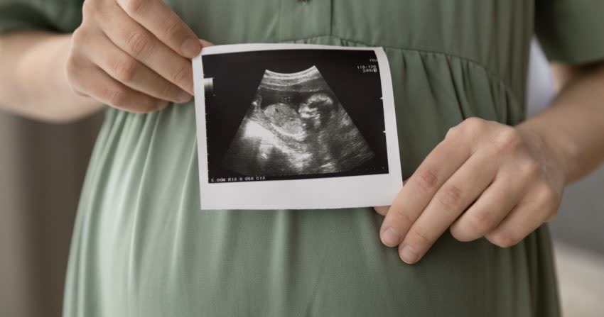 Persona in gravidanza che tiene sulla pancia un'immagine ecografica del feto