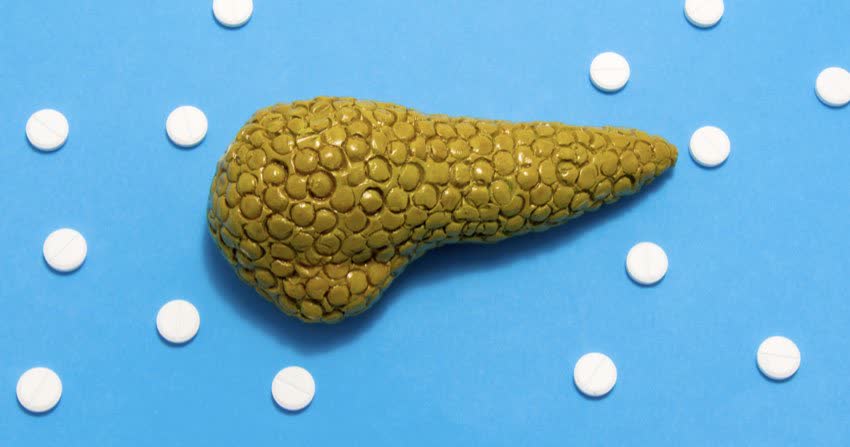 Modellino 3D di pancreas circondato da pastiglie come concetto di terapia per tumore