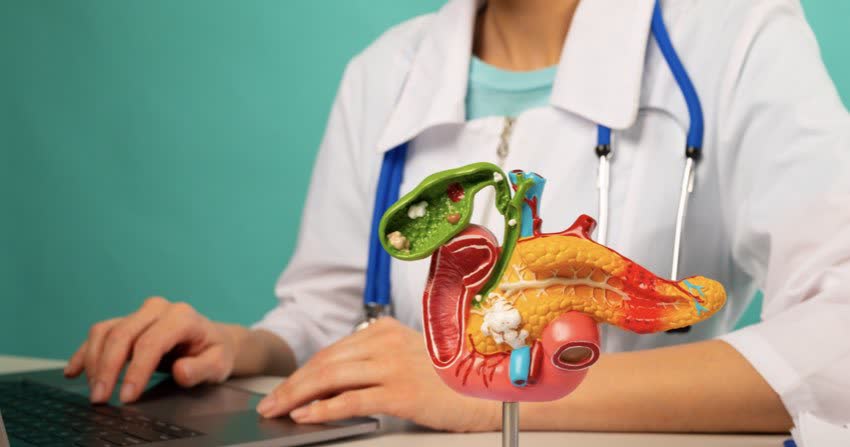 Modellino 3D pancreas e posizione anatomica con medico sullo sfondo