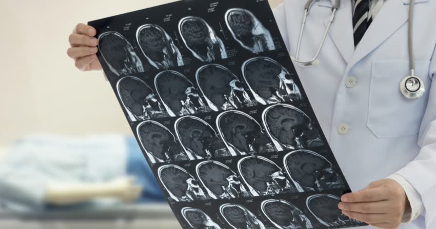 Medico osserva immagine dei tessuti del cervello date da risonanza magnetica