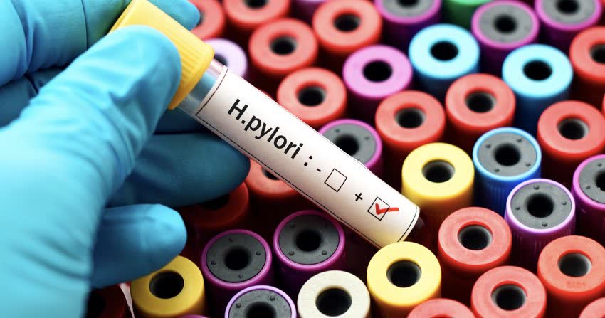 Provetta con campione biologico positivo per l'Helicobacter pylori