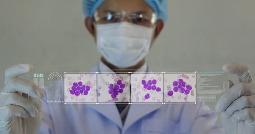 Medico che mostra cellule di leucemia su un background trasparente