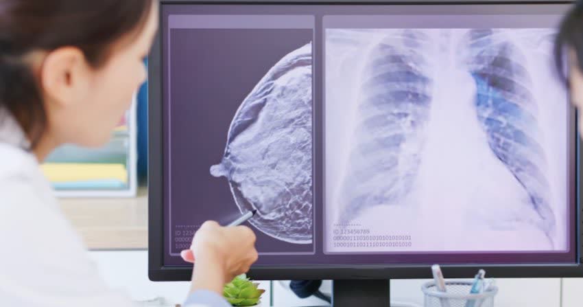 Immagini radiografiche di seno e polmoni